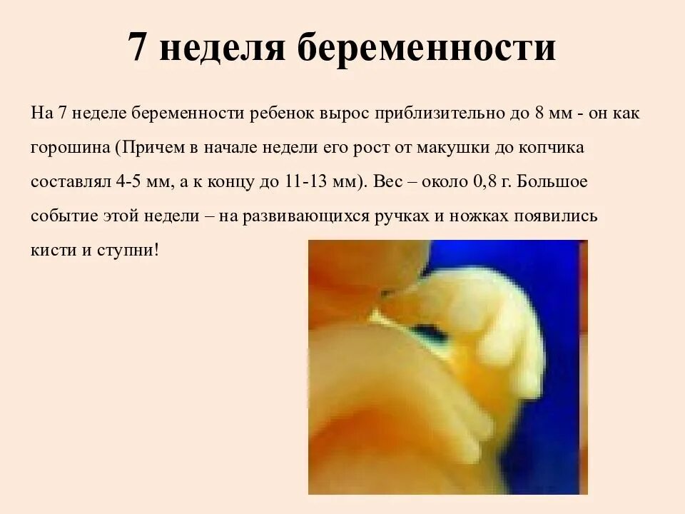 Беременность 7 недель что делать. 6-7 Недель беременности размер плода. Эмбрион 7 недель размер плода.