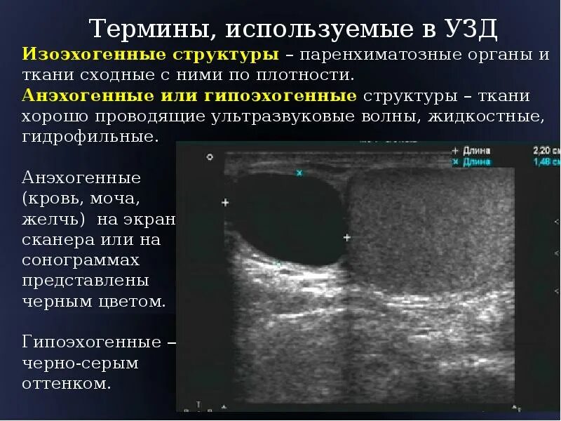 Что значит печень неоднородная. Изоэхогенное образование щитовидной железы УЗИ. Гипоэхогенное образование в печени на УЗИ что это такое. Изоэхогенная киста молочной железы. УЗИ гипоэхогенное образование молочной железы.