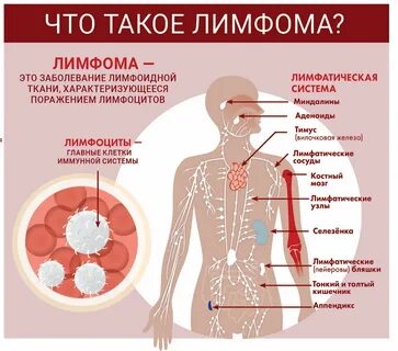 День лимфом