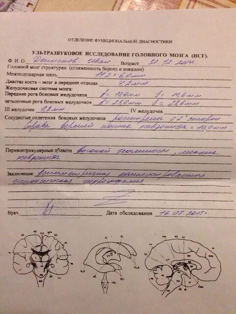 Диакарб и аспаркам показания к применению. Аспаркам реневал. Аспаркам при сотрясении мозга. Аспаркам. Диакарб и аспаркам схема приема взрослым.