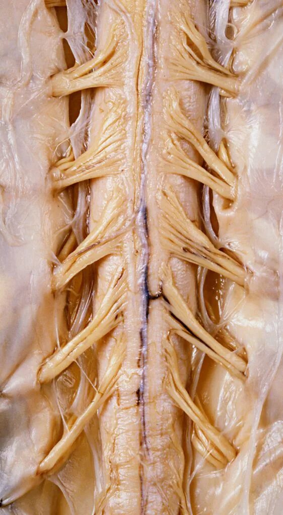 Зубчатая связка спинного мозга. Спинной мозг анатомический препарат.