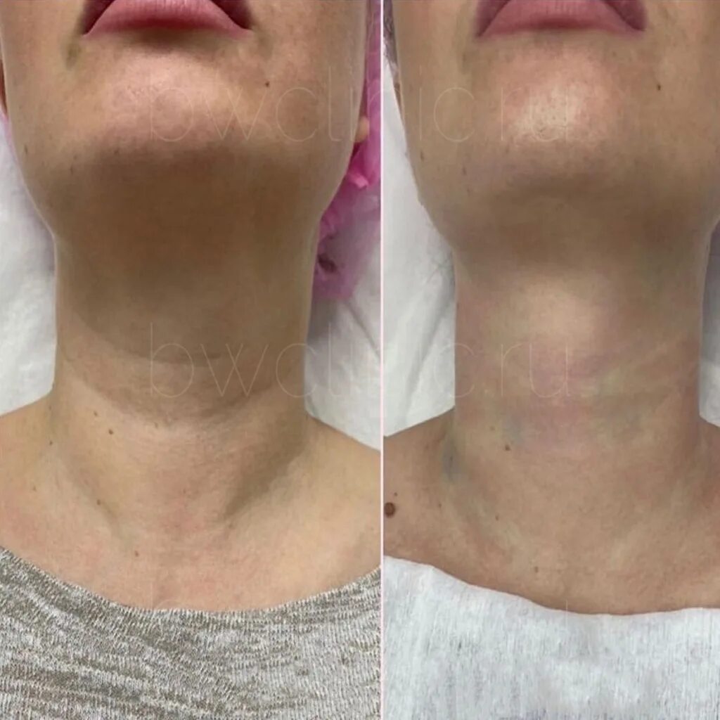 File:Neck - Tiger.jpg - Wikipedia