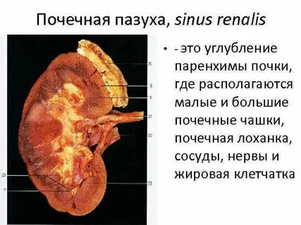 Уплотнение структур почечных синусов