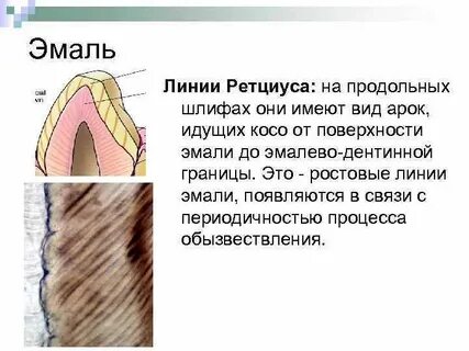 В эмали имеются