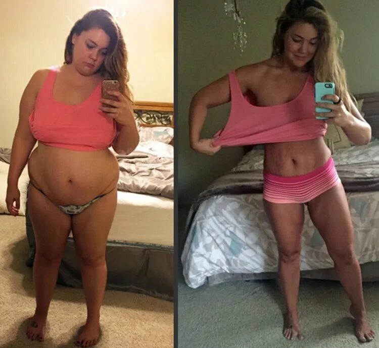 Похудение до и после ожирения. Похудение чудеса. Похудение до и после. Похудение чудеса. Реклама препаратов для похудения.