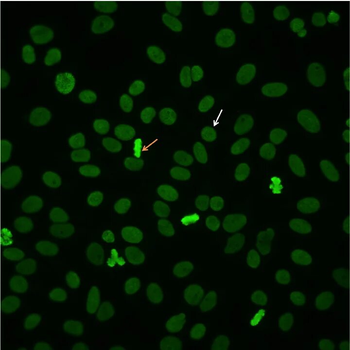 Cells 2 1 value. Hep 2 клетки. antinuclear antibodies. hep-2 cells. hk2 cell.