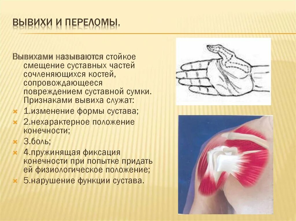 Переломы вывихи растяжения связок ушибы