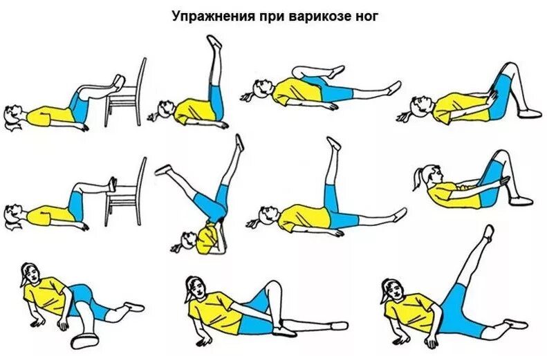 Тренировки при варикозе. Гимнастика для вен нижних конечностей при варикозе. гимнастика для ног при варикозе нижних конечностей. упражнения при варикозе нижних конечностей гимнастика. гимнастика против варикоза на ногах.
