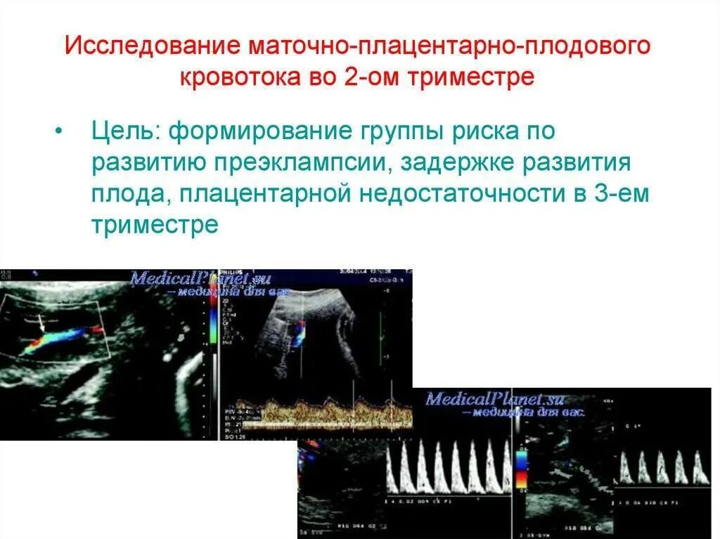 Плацентарное нарушение 1а степени. Маточно плодово плацентарный кровоток. нарушение плодового кровотока. недостаточность плодово плацентарного кровотока. нарушение маточно-плацентарного кровотока 1а степени.