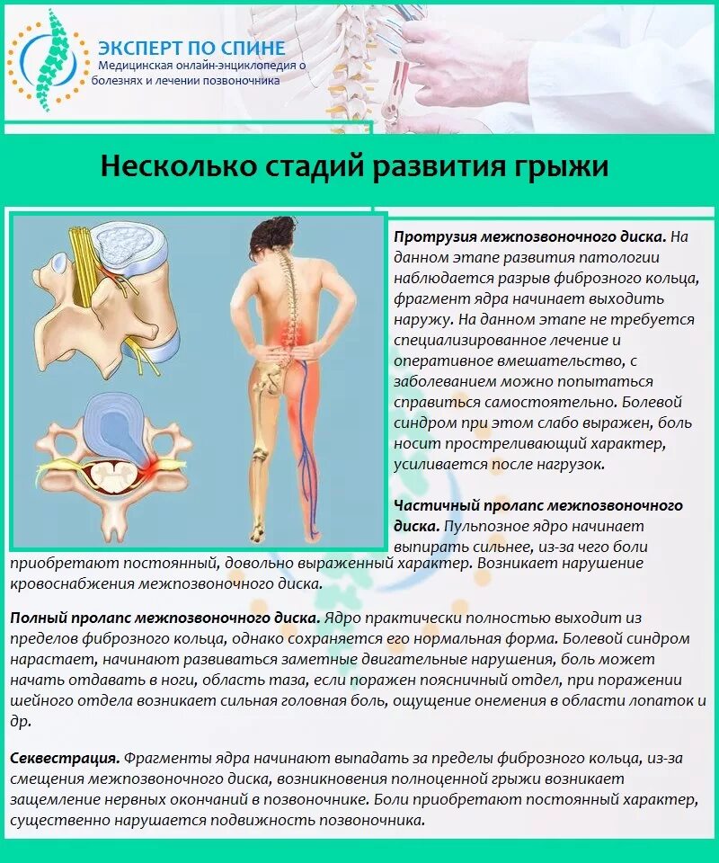 Можно ли греть грыжу поясничного. Боли при межпозвоночной грыже. Боли при грыже поясничного отдела позвоночника. При межпозвоночной грыже пояснице.