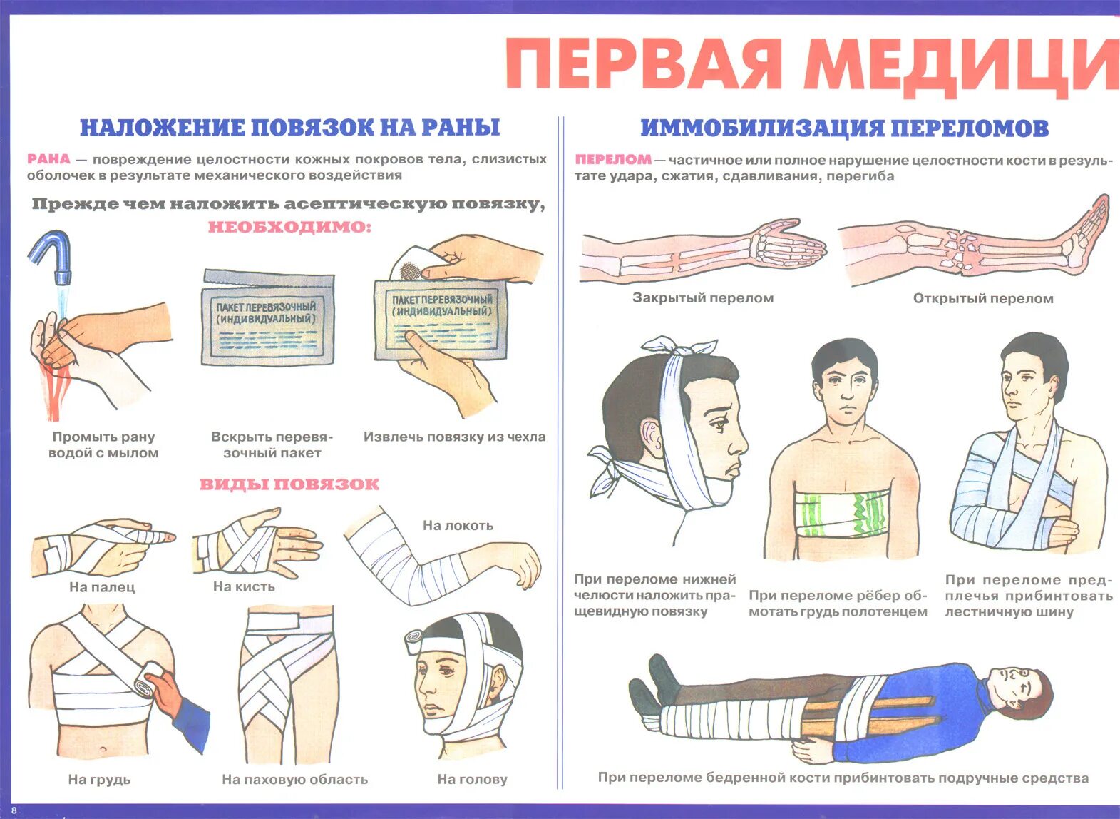 Повязка манипуляция. Гражданской обороны плакат первая мед помощь. Повязки (правила наложения, виды, схемы). Алгоритм оказания ПМП при ранах. Гражданская оборона медицинская помощь памятки.