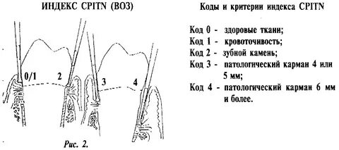 Индексы пародонта