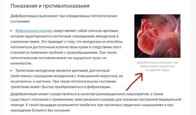 Проведение дефибрилляции сердца. Электрическая дефибрилляция показания. дефибрилляция показания методика осложнения. показания для дефибрилляции сердца. противопоказания для проведения дефибрилляции:.