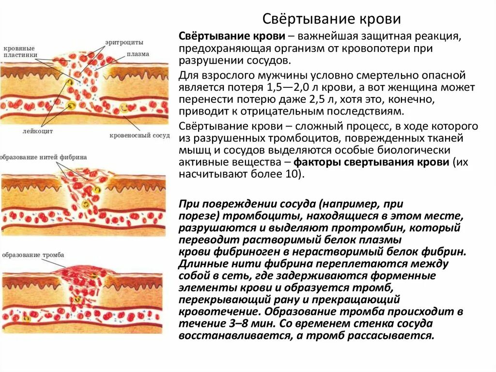 Образование тромба из фибрина