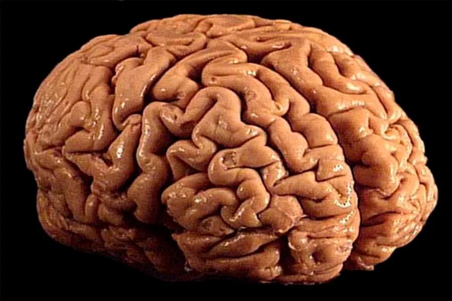 Top 10 Amazing Facts About The Human Brain - YouTube