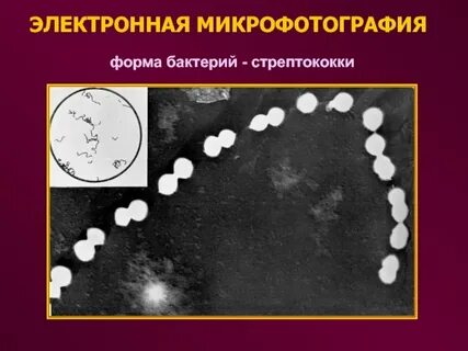 Стрептококк это прокариот