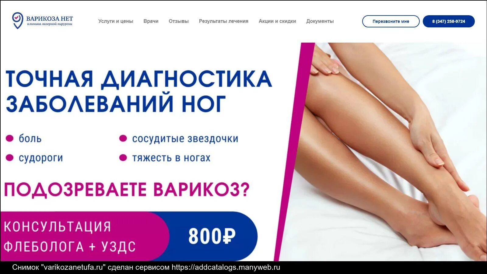 Варикоза нет улан. Варикоза нет улан
