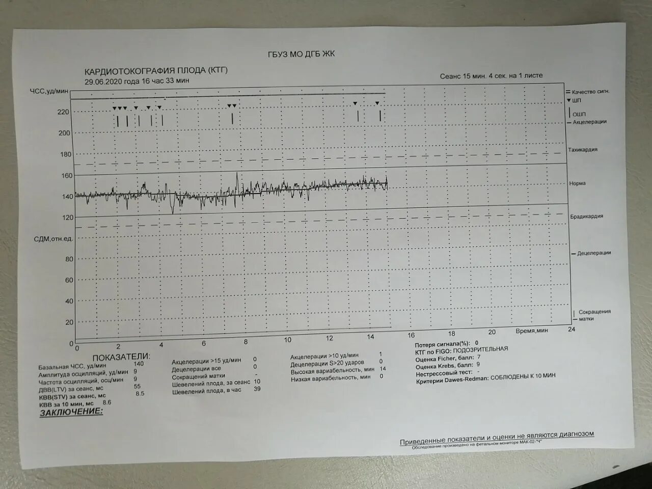 Плохие показатели КТГ. Норма шевелений плода на 35 неделе беременности. КТГ 3 триместр норма. Кардиография КТГ плода. Нормы ктг 33 недели