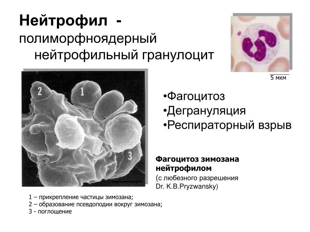 Фагоциты это нейтрофилы. Эозинофилы дегрануляции. Секреторная дегрануляция нейтрофилов. Дегрануляция нейтрофилов. Дегрануляция нейтрофилов.