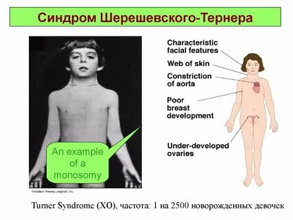 Related syndrome