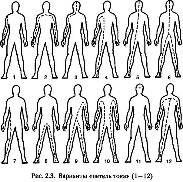 Какие петли тока наиболее опасны. Пути прохождения электрического тока. Путь («петля») тока через тело человека. Прохождение тока через тело человека. Схемы прохождения электрического тока через тело человека.