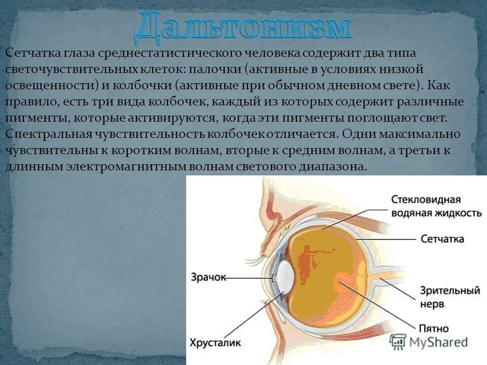 Работа сетчатки. Сетчатка и хрусталик. Дальтонизм сетчатка. Хрусталик глаза функции.