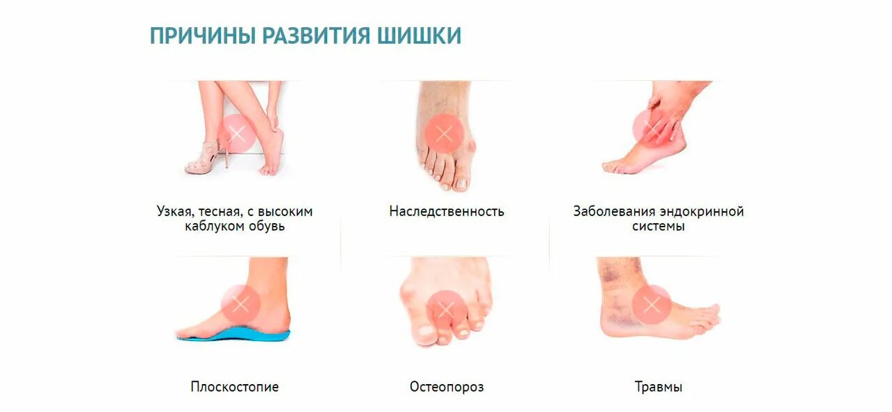 Обувь деформация стопы. Обувь деформация стопы