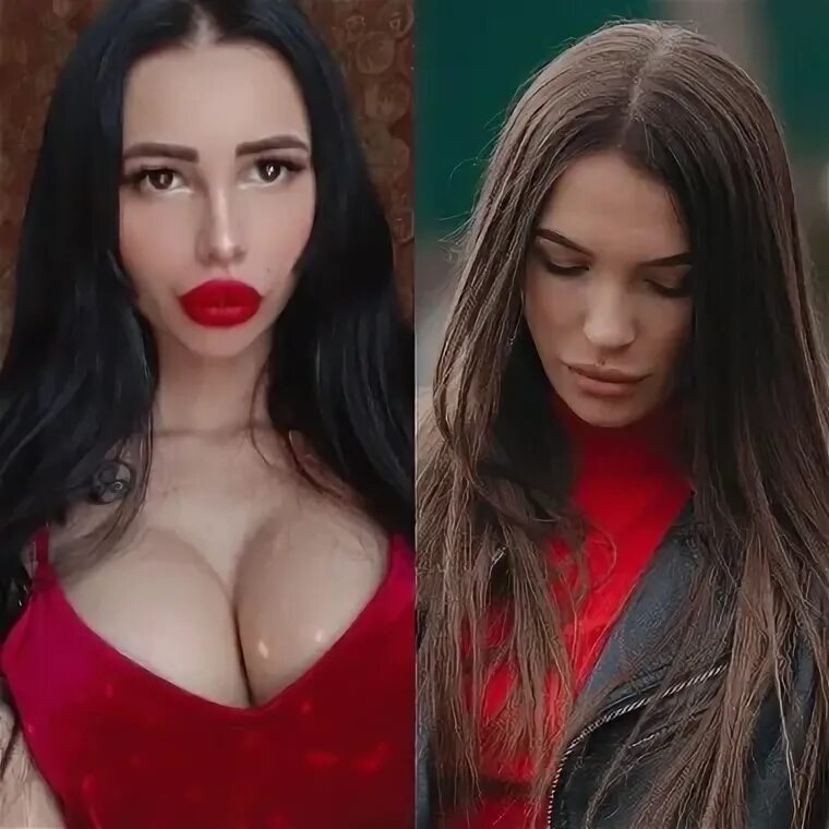 Клава до и после пластики Фото КЛАВА БЕЗВЕРХОВА ФОТО ДО И ПОСЛЕ