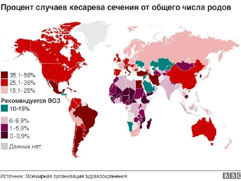 Статистика родов в россии. Статистика кесарева сечения в мире на 2021. Частота кесарева сечения в мире 2021. Процент кесаревых сечений в России 2020. Статистика кесарева сечения в России 2021.