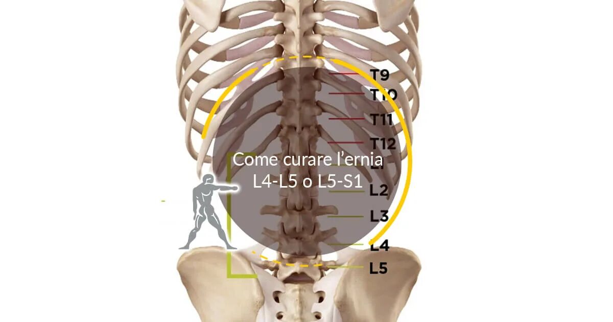 L 5 ni