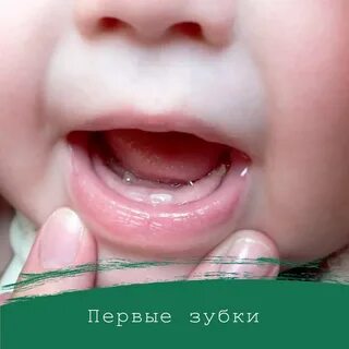Беспокоят зубки