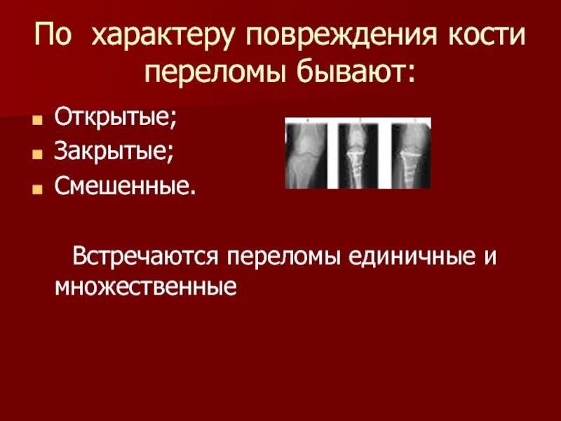 По характеру повреждения кости. По характеру повреждения кости переломы бывают. Единичные и множественные переломы. По характеру повреждения кости выделяют переломы полные.