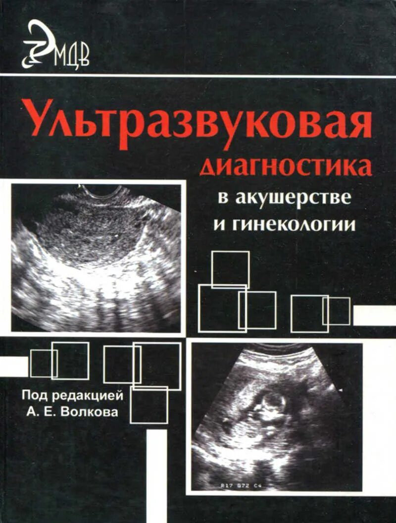 Узд акушерство. Узд акушерство. Ультразвуковое исследование (узи). Ультразвуковое исследование (узи). Ультразвуковое исследование (узи).