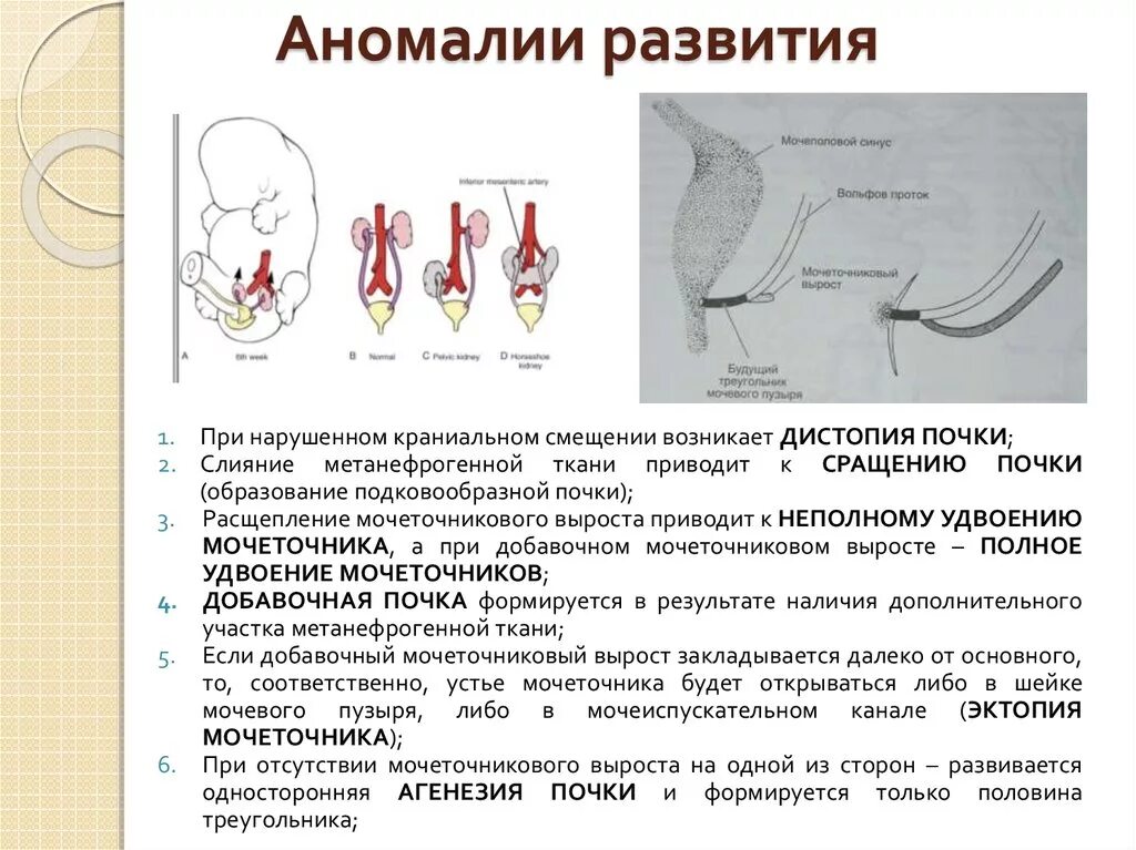 Недоразвитая матка у мужчин. Пороки развития почек и мочеполовой системы. Пороки развития органов мочеполового аппарата. Аномалии развития мочеточников и мочевого пузыря. Аномалии развития органов мочеполовой системы.