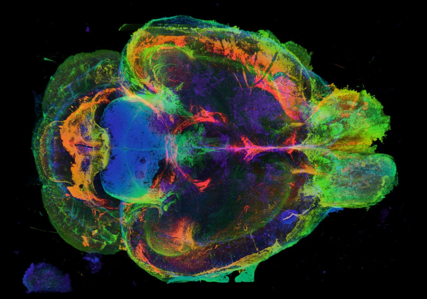 Brain imaging. Коннектом мозга. Коннектом мозга человека это. Трактография головного мозга. Нейровизуализация головного мозга.