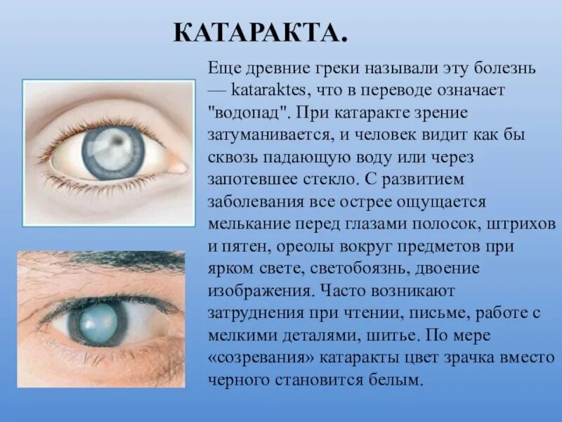 Один из супругов страдает глаукомой. Поражение органов зрения. Сообщение о заболеваниях глаз. Нарушение органов зрения. Нарушение зрения заболевания.