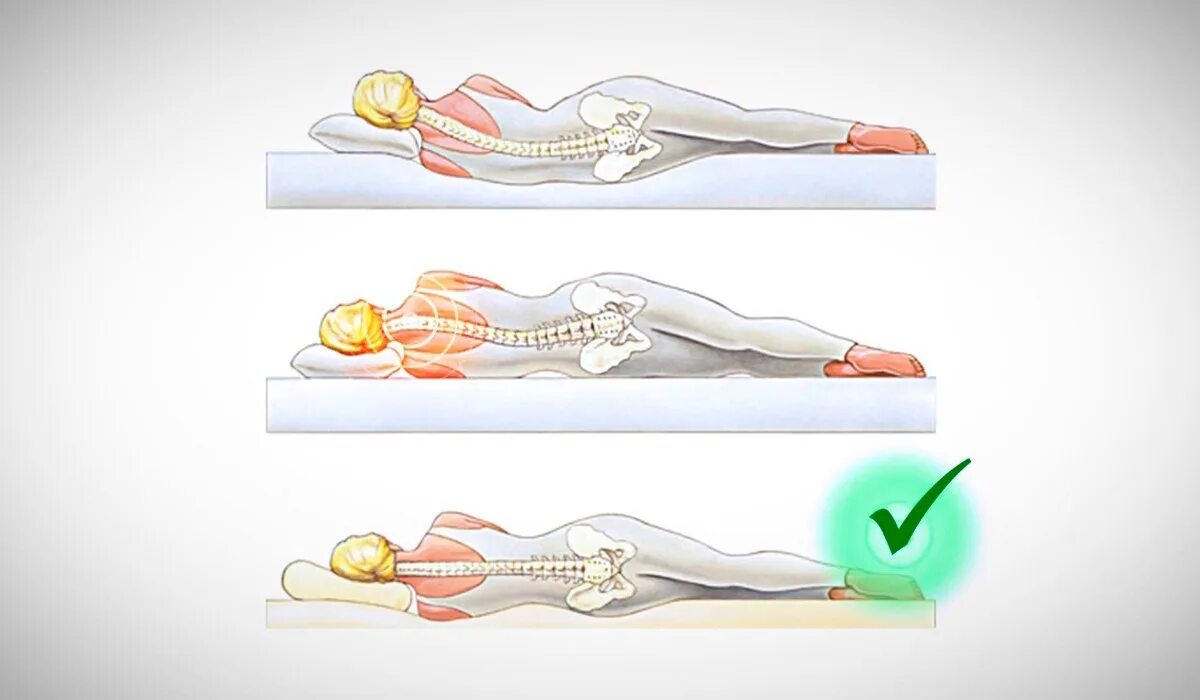 Болит спина от матраса. Правильное положение позвоночника во сне. Правильное положение позвоночника во время сна. Правильное положение сна на спине. Правильное положение позвоночника на подушке.