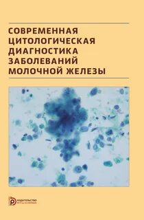 Цитологический диагноз