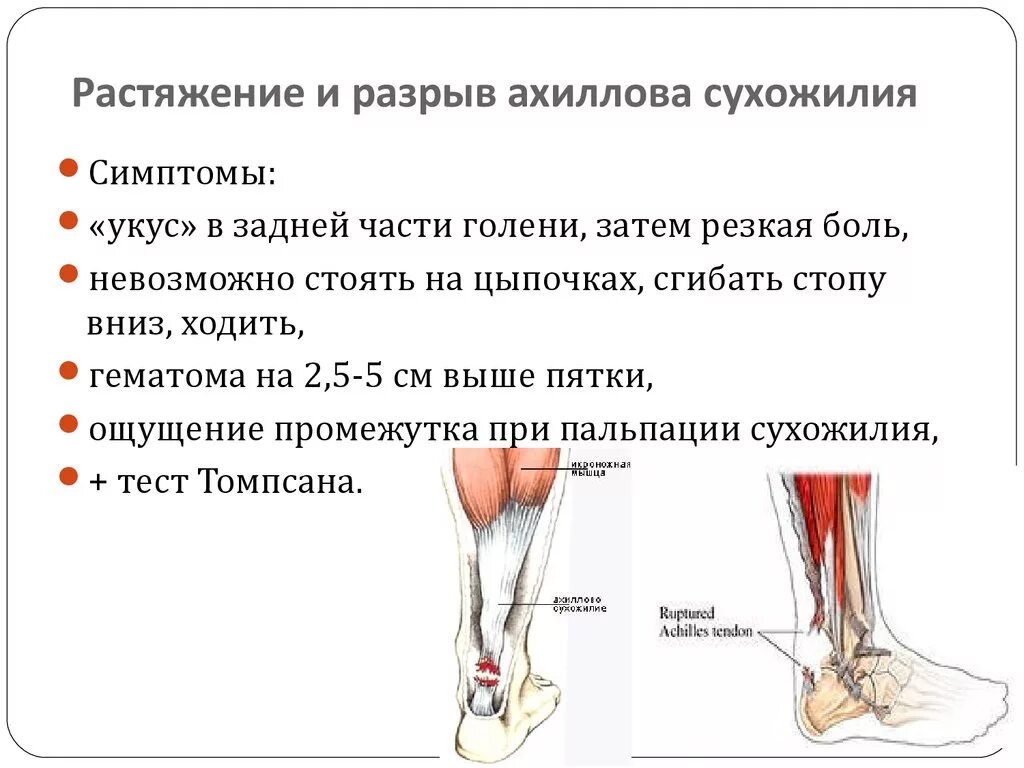 Слабость ахиллесова