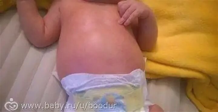 Живот новорожденного ребенка. Животик новорожденного. Почему у детей большой живот. Почему у детей большой живот. Вздутый животик у ребенка 2 года.