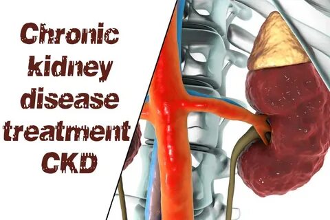 Chronic kidney disease