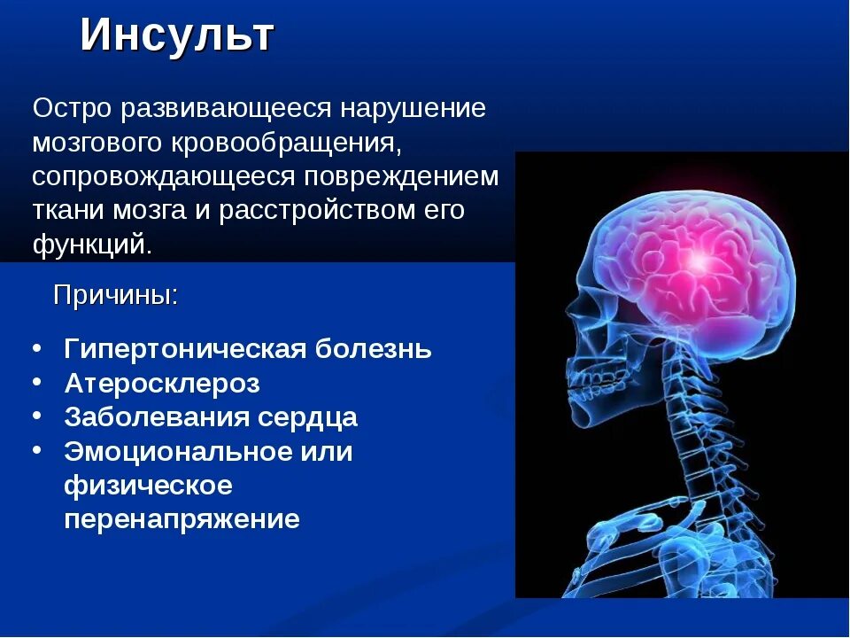 Нарушение центральной нервной системы. Острые заболевания центральной нервной системы. Презентация на тему инсульт. Инсульт нервной системы.