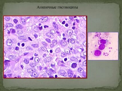 Макрофаги гистиоциты