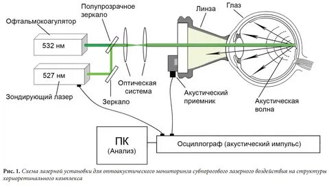 Как установить лазер