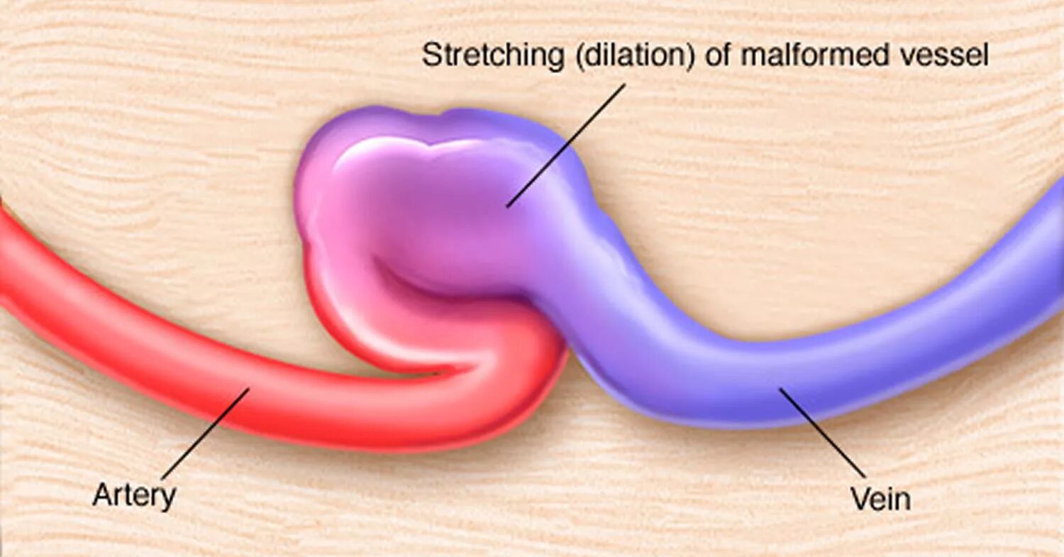 Malformed response