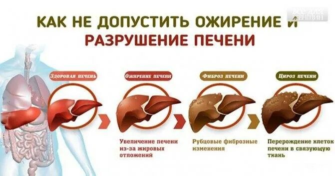 Диета при гепатозе печени у мужчин. Гепатоз ожирение печени. Диета при ожирении печени. Ожирение печени гепатоз диета. Диета при жирового гепатоза.