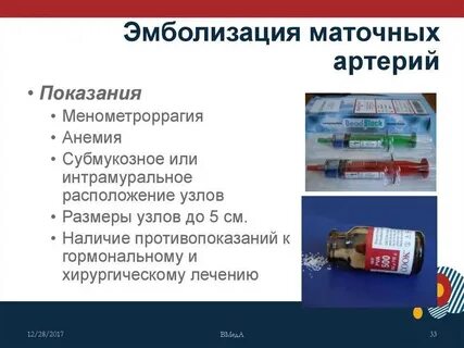 После эмболизации маточных артерий