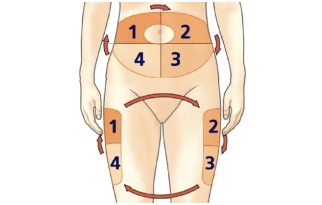 В каком месте можно ставить. Зоны инъекций инсулина в живот. Схема чередования мест инъекций инсулина. Зоны уколов инсулина. Места инъекций инсулина.