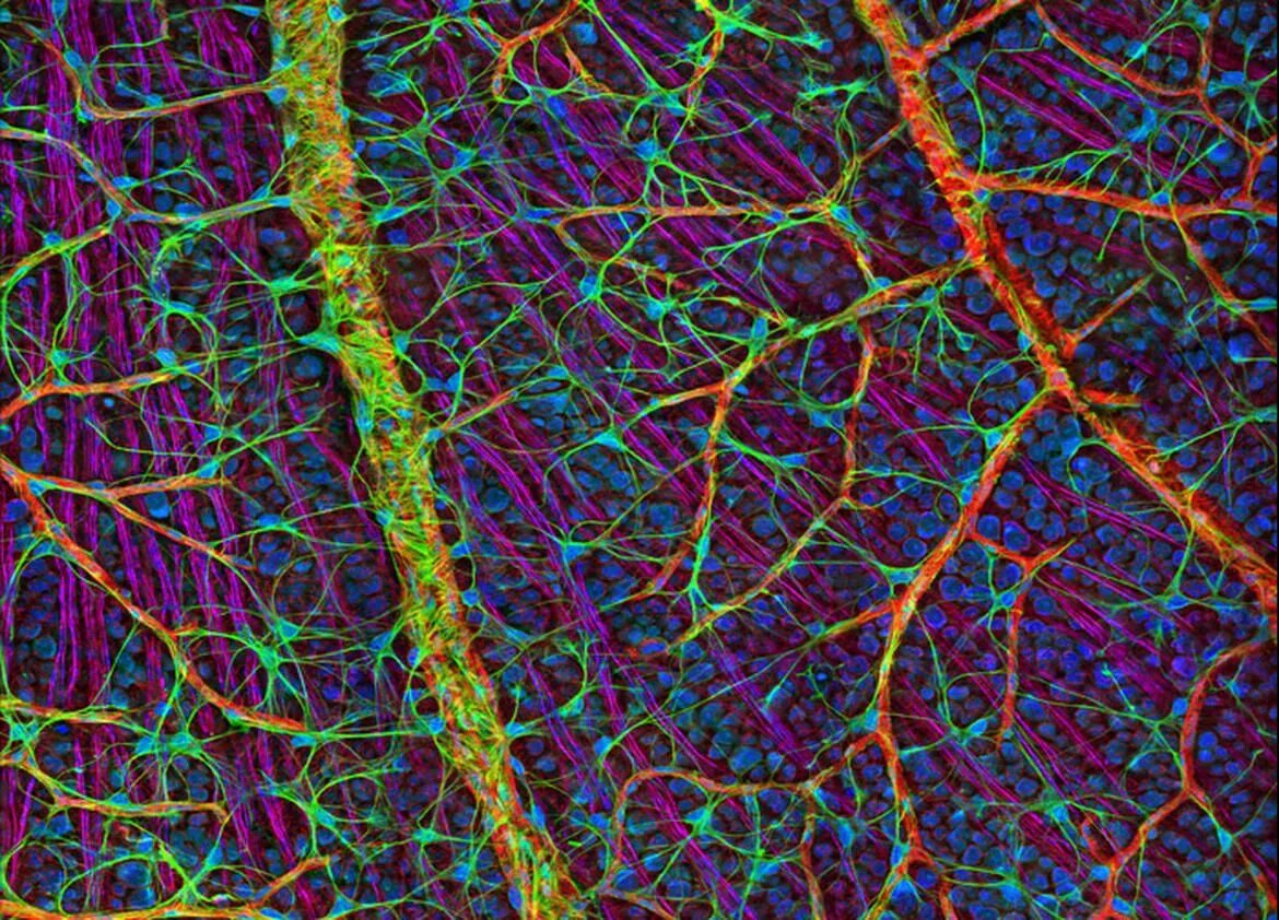 Клетки сетчатки глаза под микроскопом. Сетчатка глаза под микроскопом. Нервная ткань сетчатки глаза. Нервная ткань сетчатки глаза под микроскопом. Сетчатка ткань