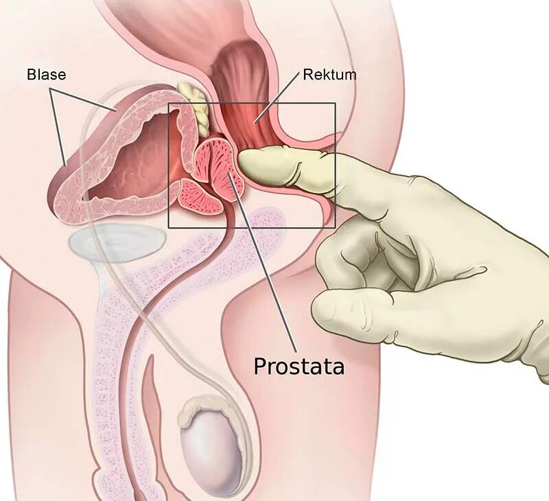 Предстательная железа у мужчин. Предстательной железе где находится. Предстательной железе где находится. Где простата у женщин. Простата бывает у женщин.